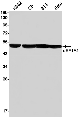 eEF1A1/EF-Tu Rabbit mAb ABZ2303