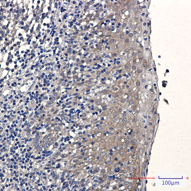 eEF1A1/EF-Tu Rabbit mAb ABZ2304