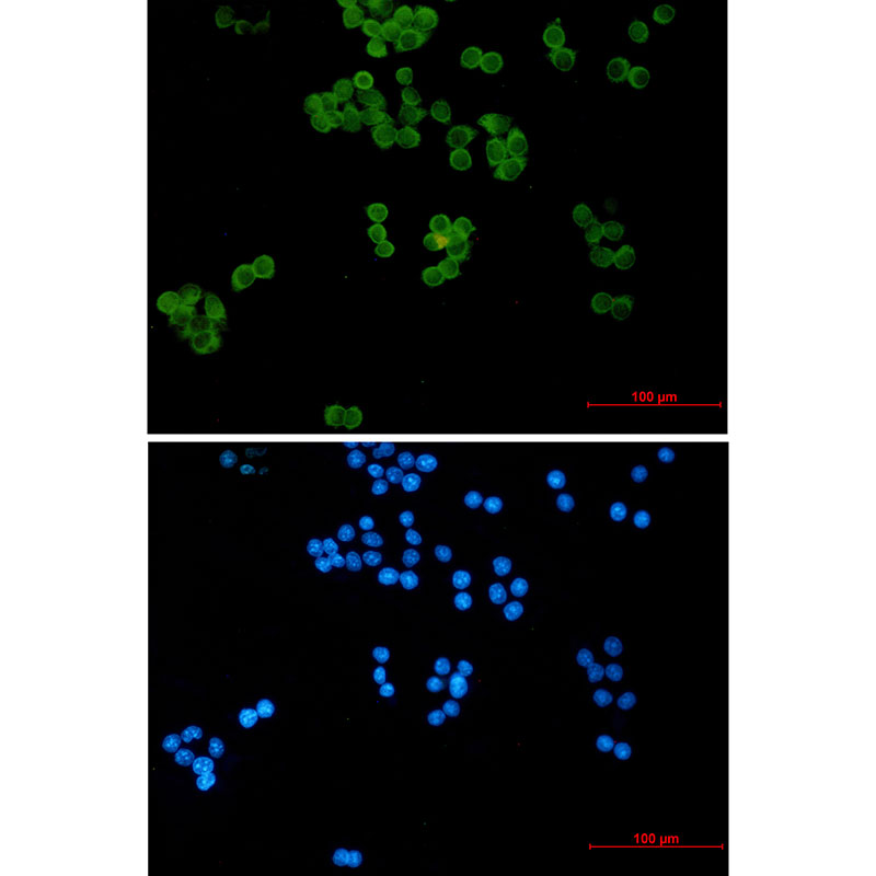 Ubiquitin Conjugating Enzyme E2 L3 Rabbit mAb ABZ2305