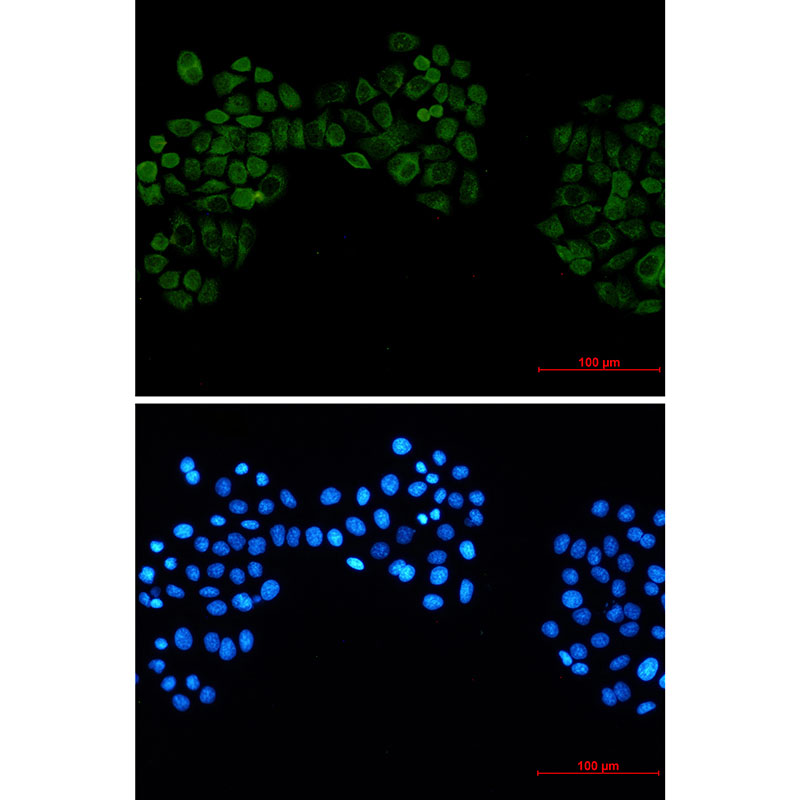 Casein Kinase 2 beta Rabbit mAb ABZ2306