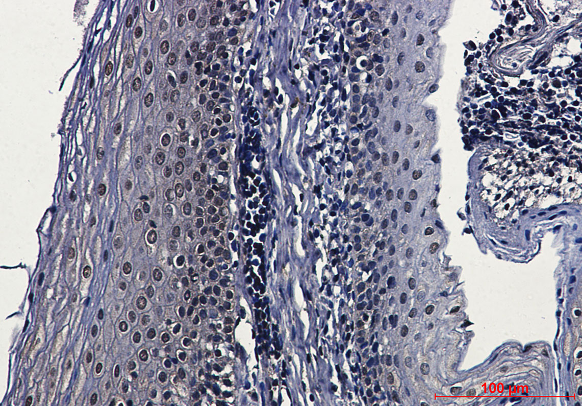 Casein Kinase 2 beta Rabbit mAb ABZ2306