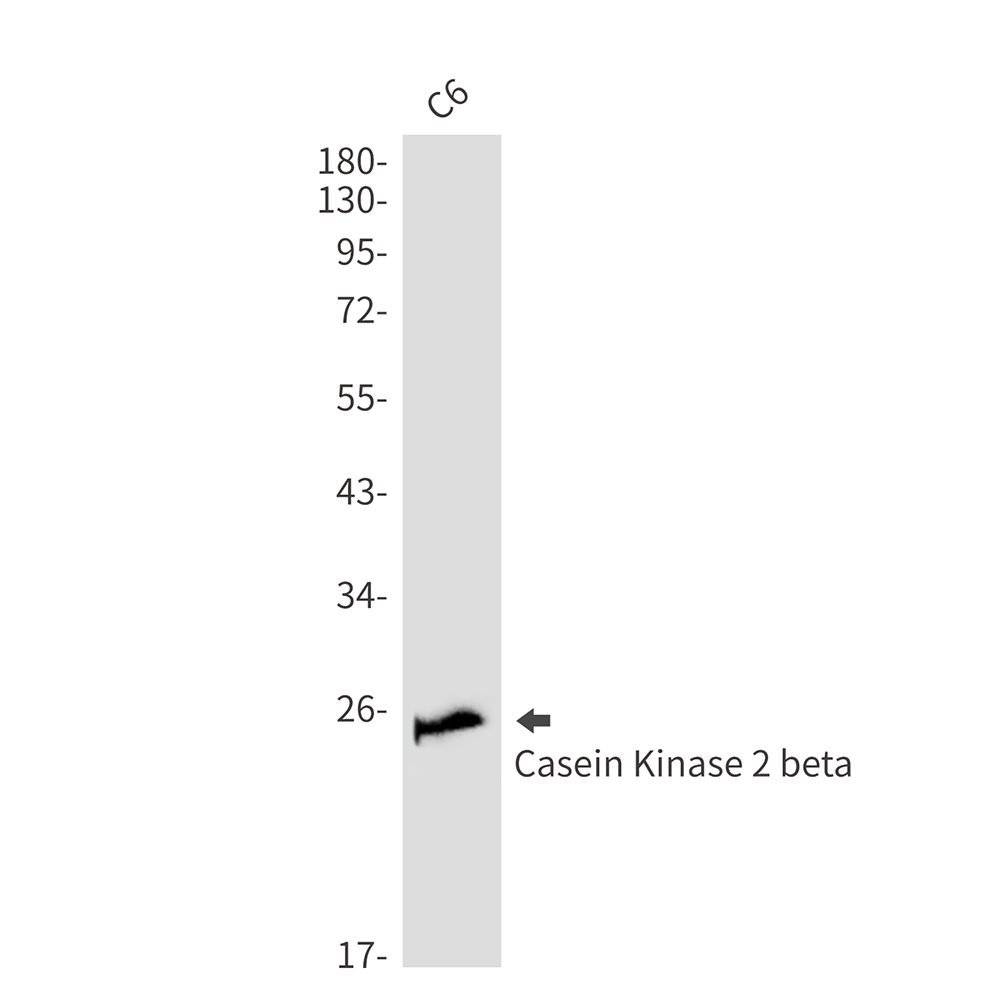 Casein Kinase 2 beta Rabbit mAb ABZ2306
