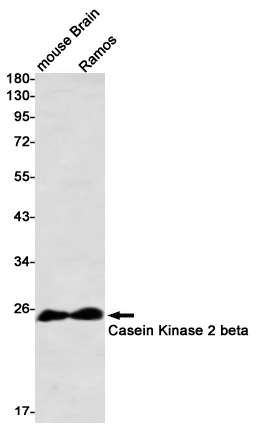 Casein Kinase 2 beta Rabbit mAb ABZ2306