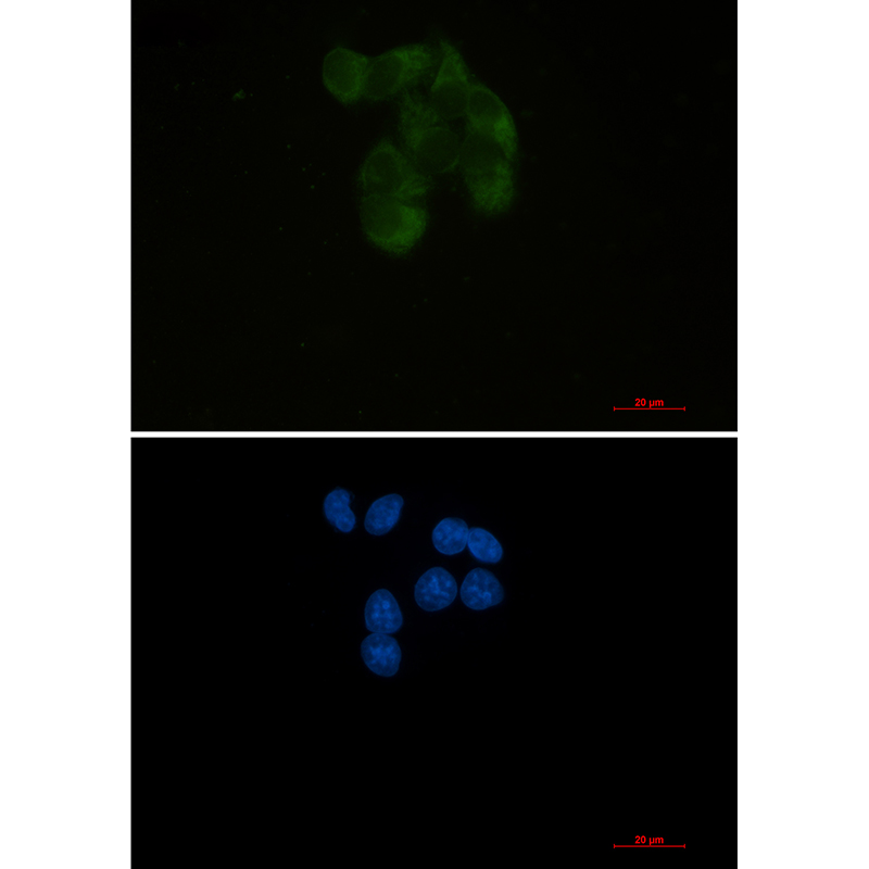 YB1 Rabbit mAb ABZ2307