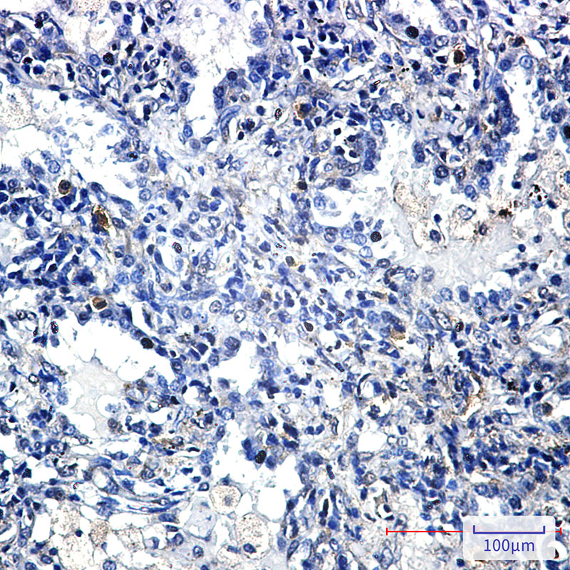 YB1 Rabbit mAb ABZ2307