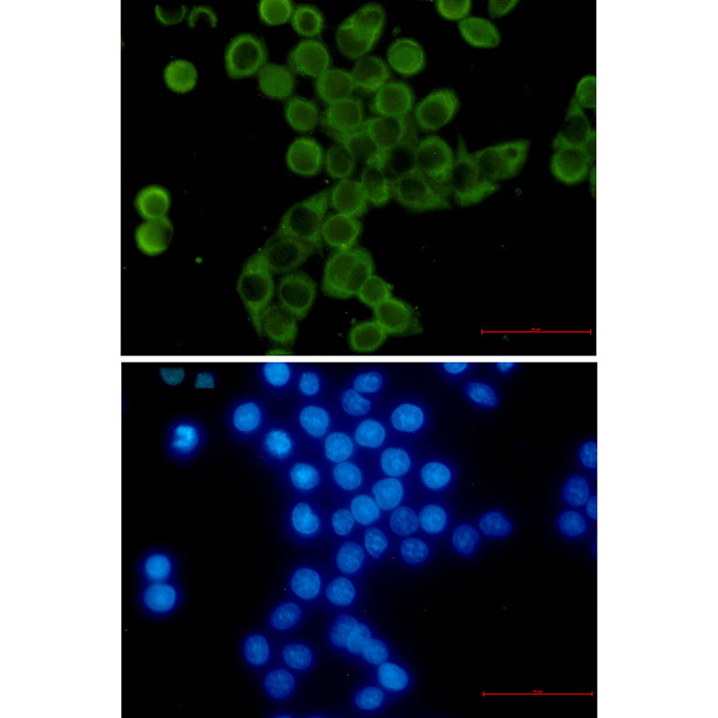 YB1 Rabbit mAb ABZ2308