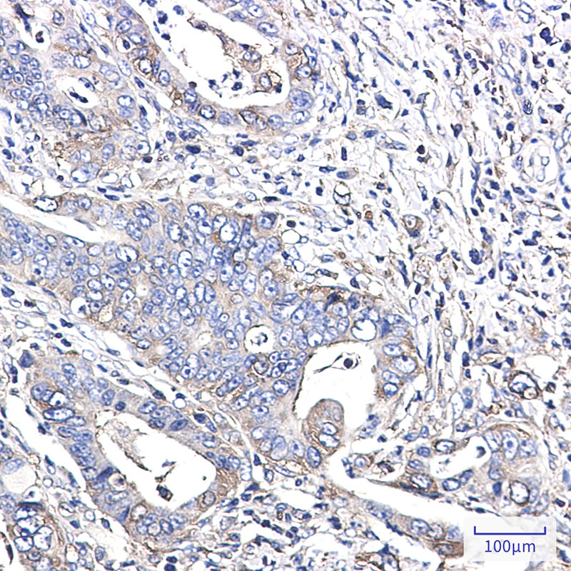YB1 Rabbit mAb ABZ2308