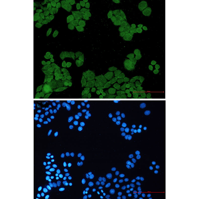 PP2A alpha/beta Rabbit mAb ABZ2309
