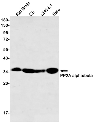PP2A alpha/beta Rabbit mAb ABZ2309