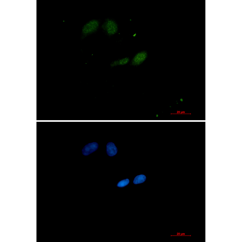 SUMO Conjugating Enzyme UBC9 Rabbit mAb ABZ2310