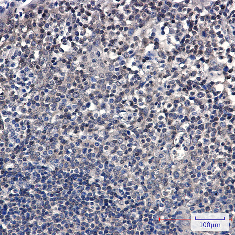 SUMO Conjugating Enzyme UBC9 Rabbit mAb ABZ2310