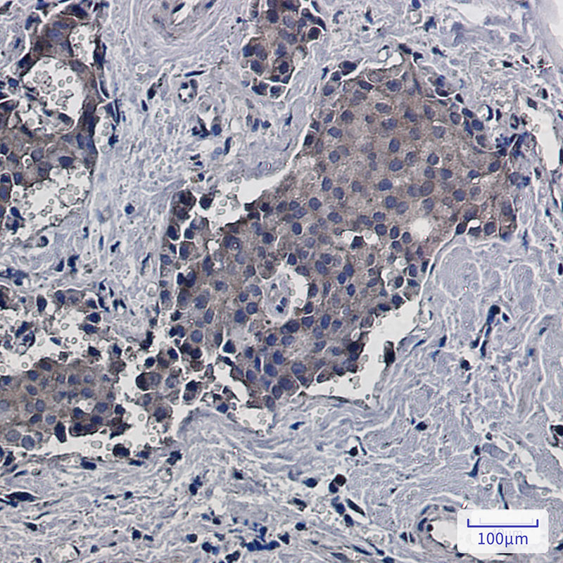 RACK1 Rabbit mAb ABZ2311