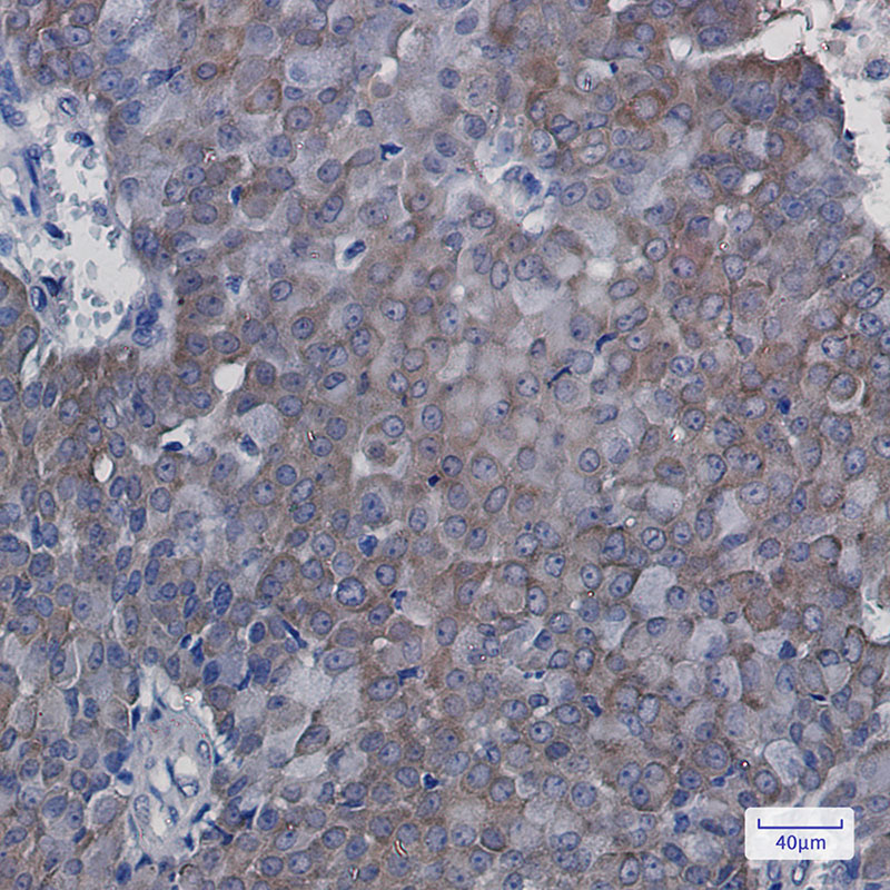 eIF5A Rabbit mAb ABZ2312