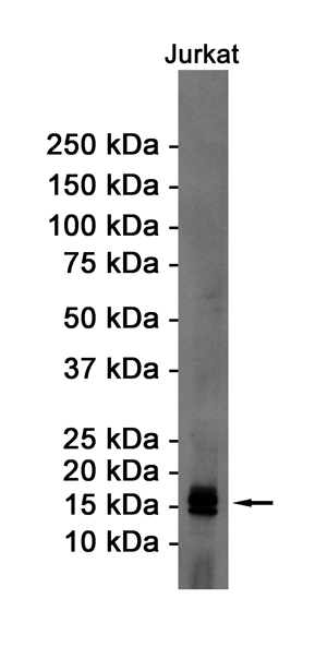 eIF5A Rabbit mAb ABZ2312