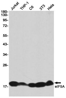 eIF5A Rabbit mAb ABZ2312