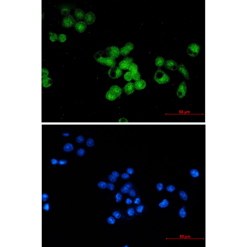 Skp1 Rabbit mAb ABZ2313