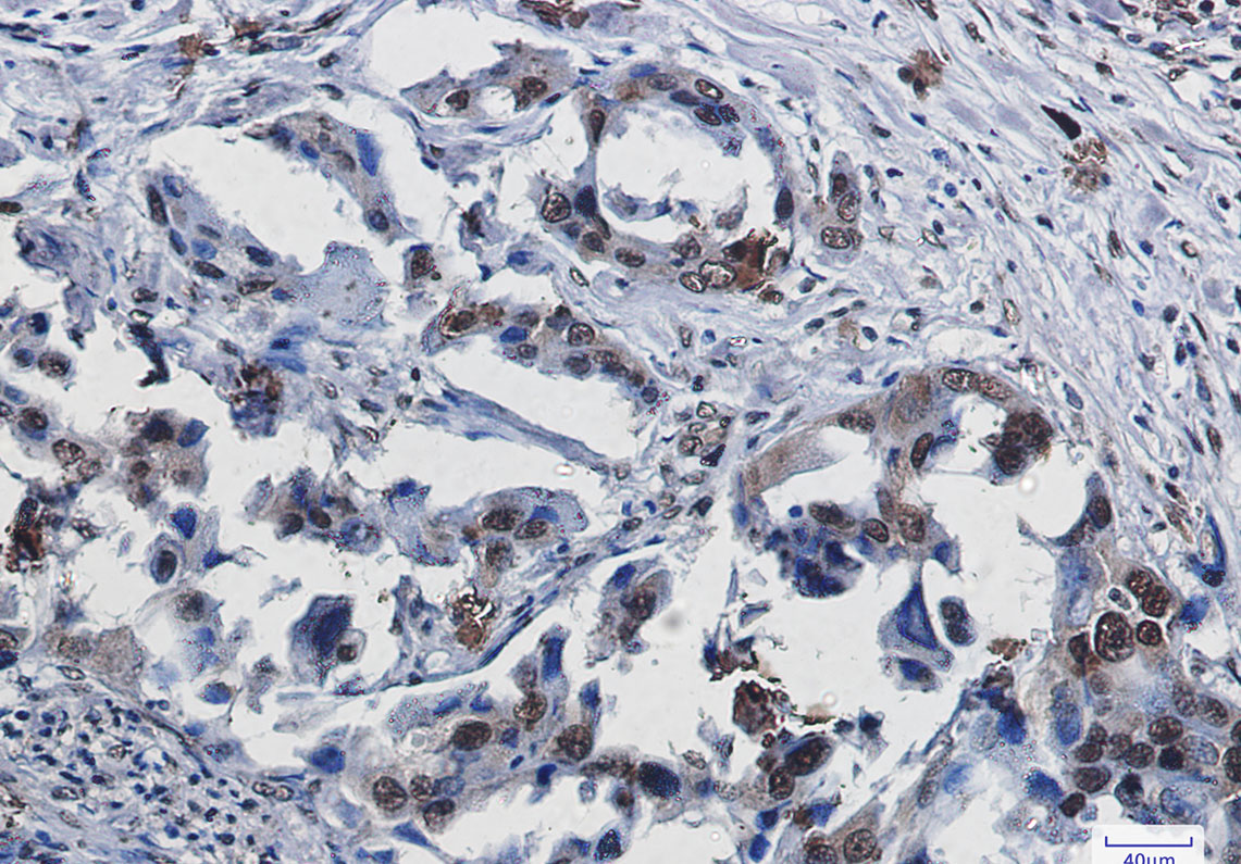 SUMO1 Rabbit mAb ABZ2315