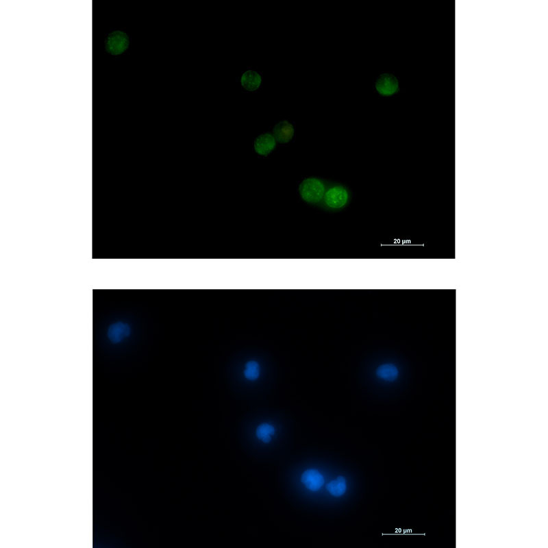 VAMP2 Rabbit mAb ABZ2316