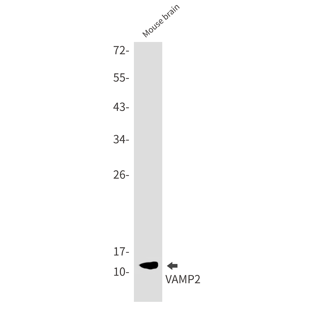 VAMP2 Rabbit mAb ABZ2316