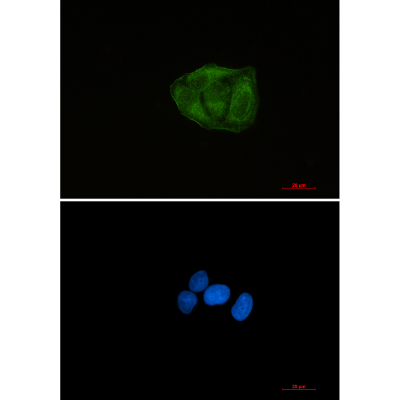 Ubiquitin 60S Ribosomal Protein L40 Rabbit mAb ABZ2318