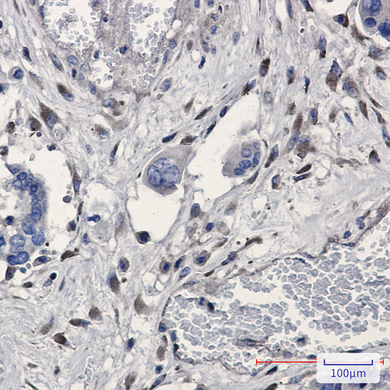 GNB2 Rabbit mAb ABZ2319