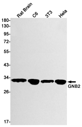GNB2 Rabbit mAb ABZ2319