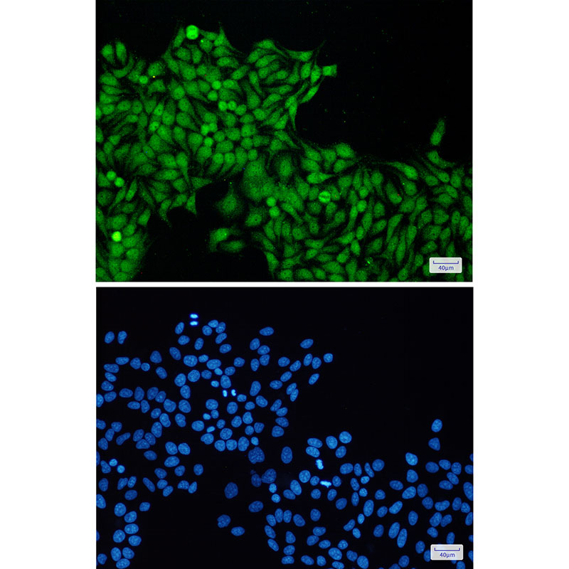 RBX1 Rabbit mAb ABZ2320
