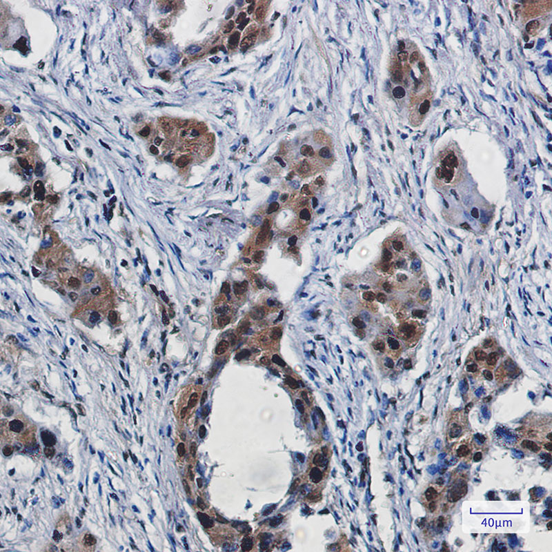 RBX1 Rabbit mAb ABZ2320