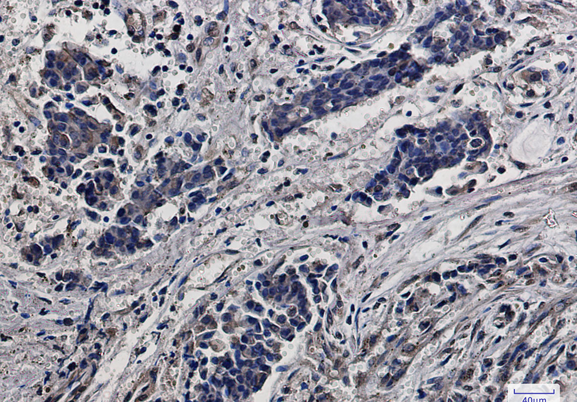 RPS6 Rabbit mAb ABZ2323