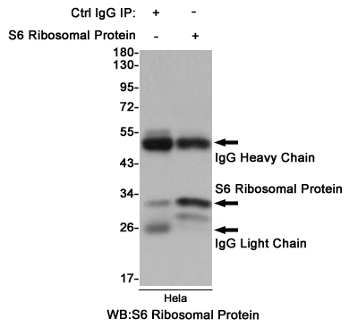 RPS6 Rabbit mAb ABZ2323