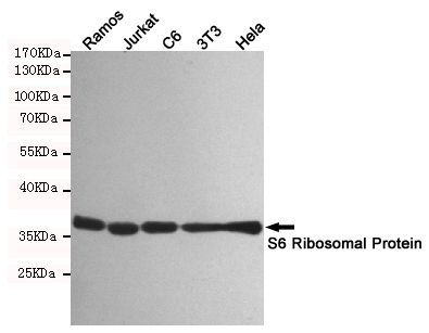 RPS6 Rabbit mAb ABZ2323