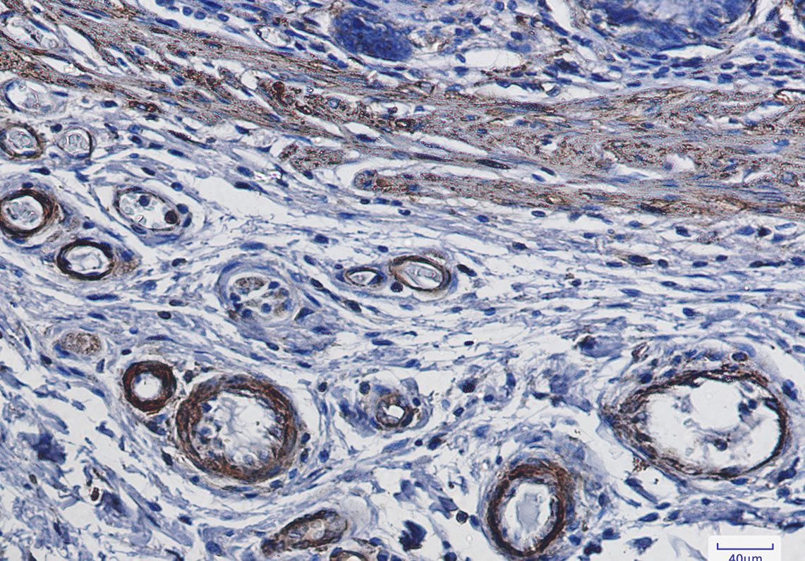 alpha Smooth Muscle Actin Rabbit mAb ABZ2324