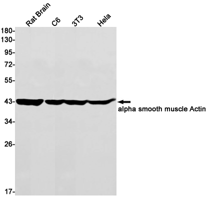 alpha Smooth Muscle Actin Rabbit mAb ABZ2324