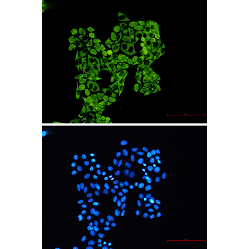 RPS8 Rabbit mAb ABZ2326