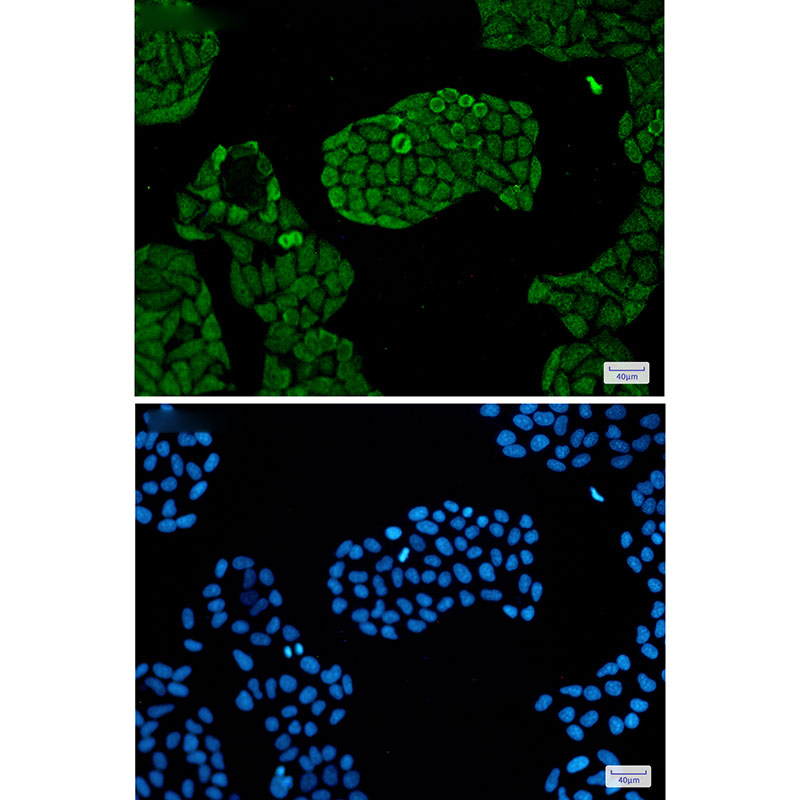PSMC5 Rabbit mAb ABZ2327