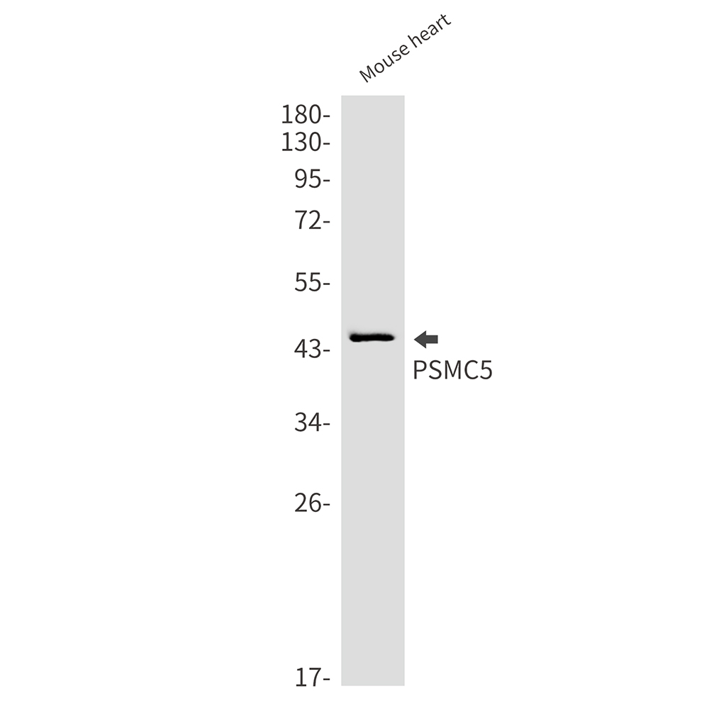 PSMC5 Rabbit mAb ABZ2327