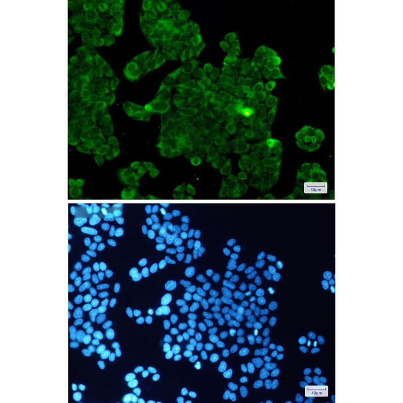 PPP1CB Rabbit mAb ABZ2328