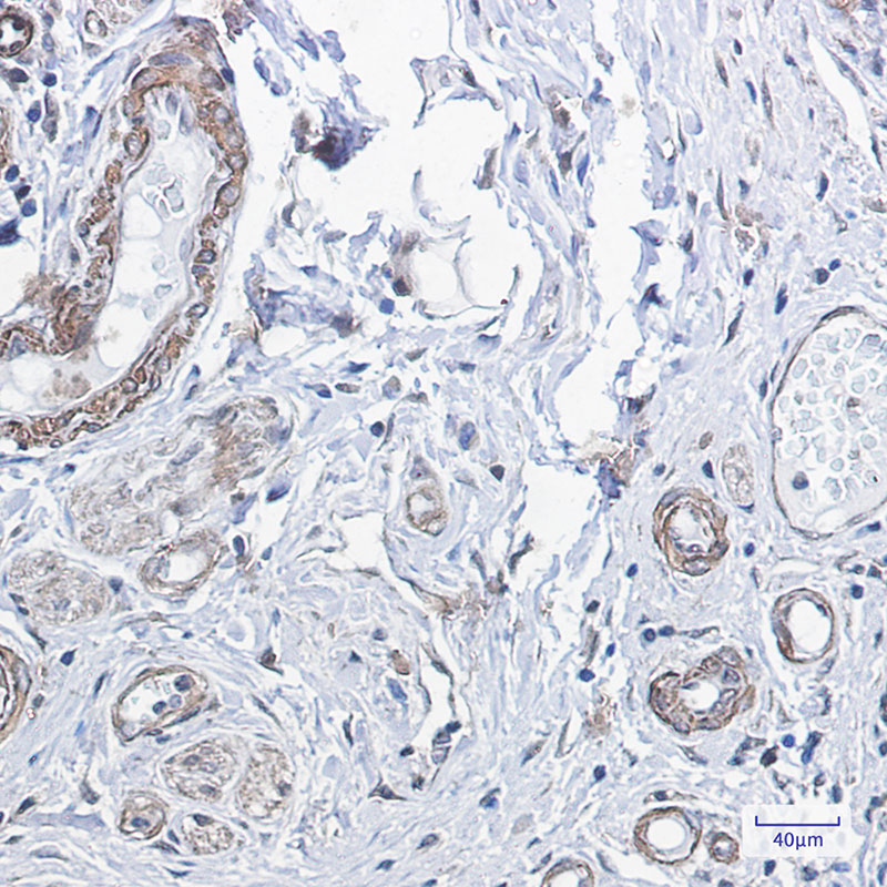 PPP1CB Rabbit mAb ABZ2328
