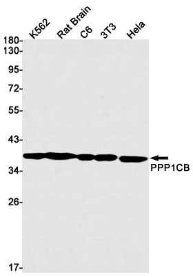 PPP1CB Rabbit mAb ABZ2328