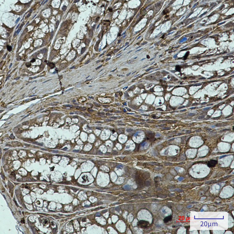 PP1C alpha/beta Rabbit mAb ABZ2329