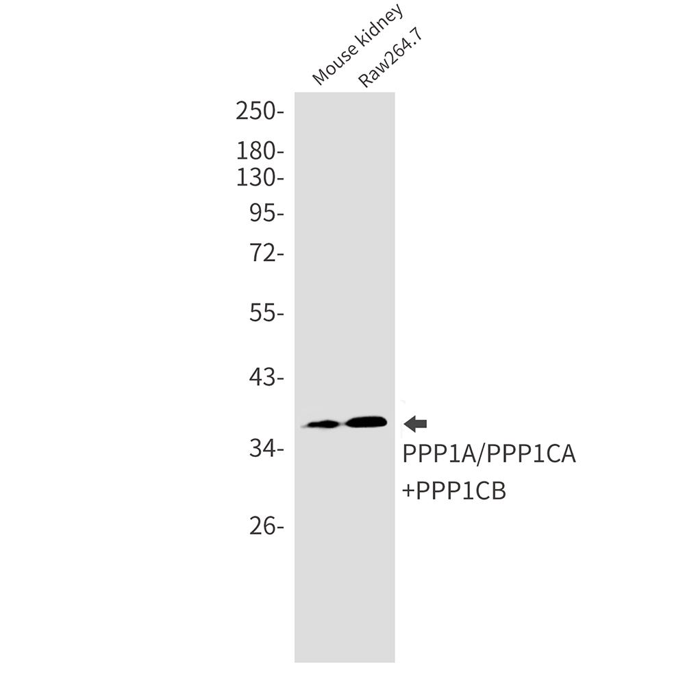 PP1C alpha/beta Rabbit mAb ABZ2329