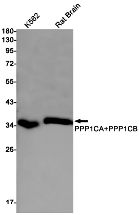 PP1C alpha/beta Rabbit mAb ABZ2329