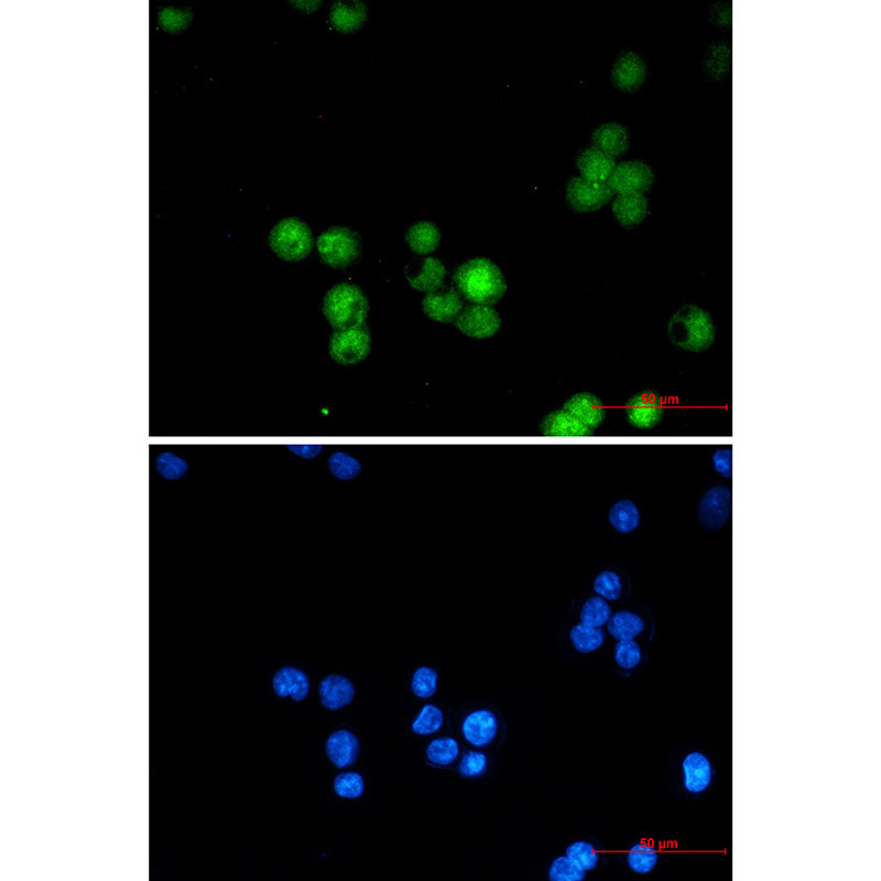hnRNP K Rabbit mAb ABZ2331