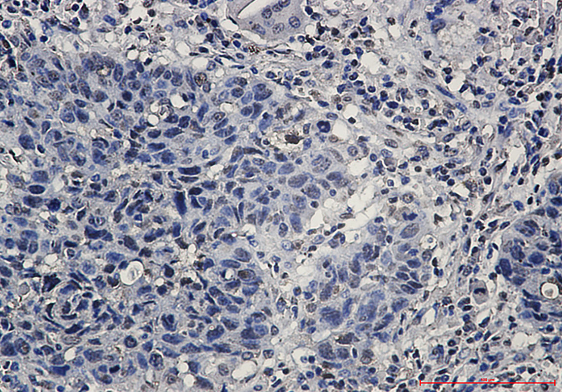 hnRNP K Rabbit mAb ABZ2331