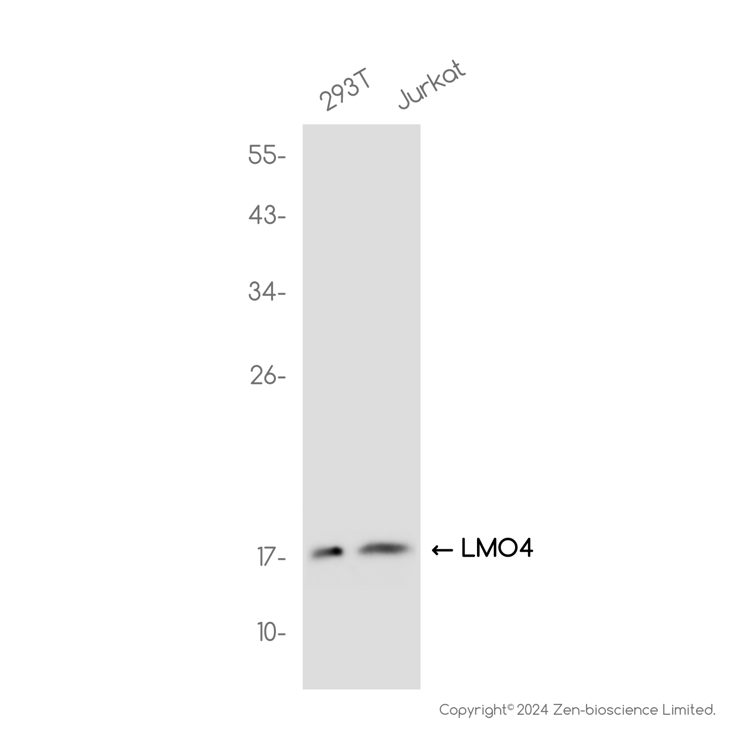 LMO4 Rabbit mAb ABZ2332