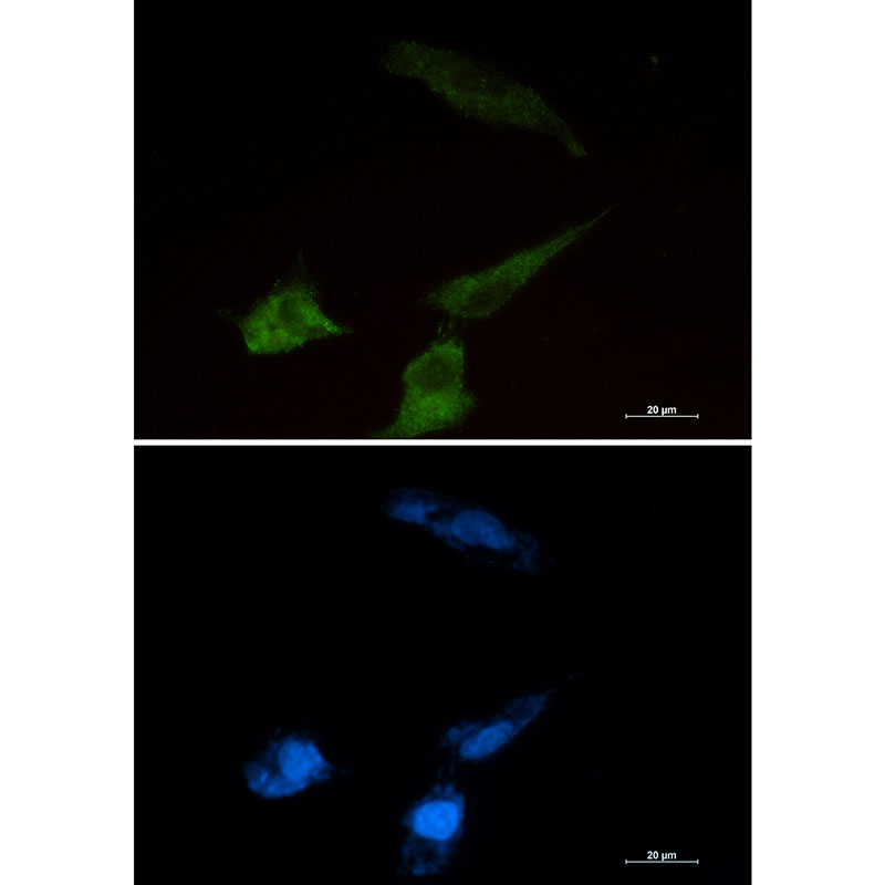 Niemann Pick C2 Rabbit mAb ABZ2334