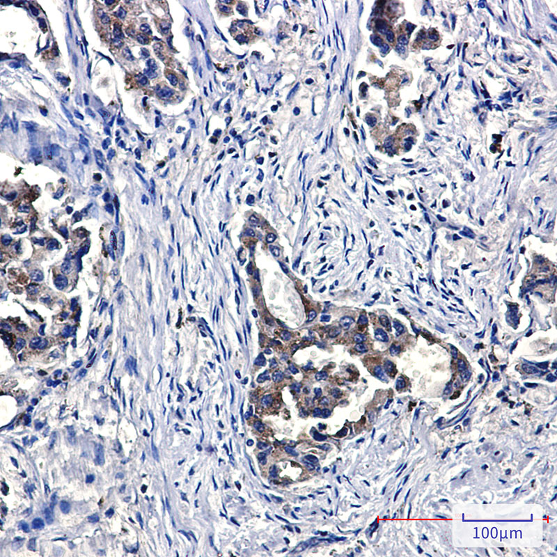 Niemann Pick C2 Rabbit mAb ABZ2334