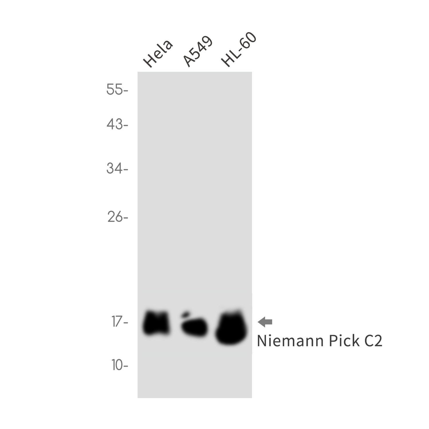 Niemann Pick C2 Rabbit mAb ABZ2334