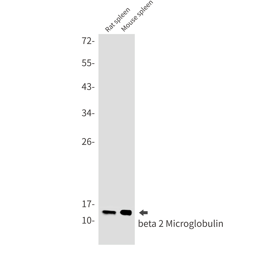 beta 2 Microglobulin Rabbit mAb ABZ2335