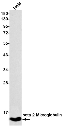 beta 2 Microglobulin Rabbit mAb ABZ2335